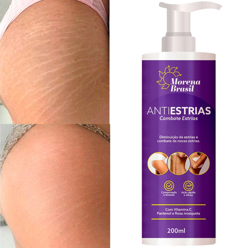 Morena Brasil – O Creme Anti-Estrias Que Valoriza Sua Pele Natural